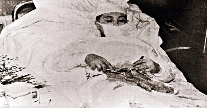 В 1961 году советский доктор прооперировал себя сам!