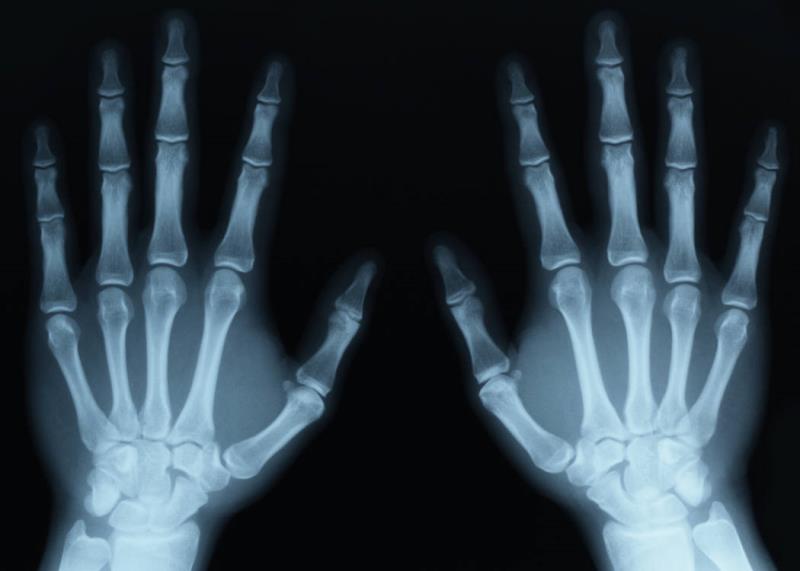 Science Trivia Question: Who discovered x-rays? Science Trivia Question: Who discovered x-rays?