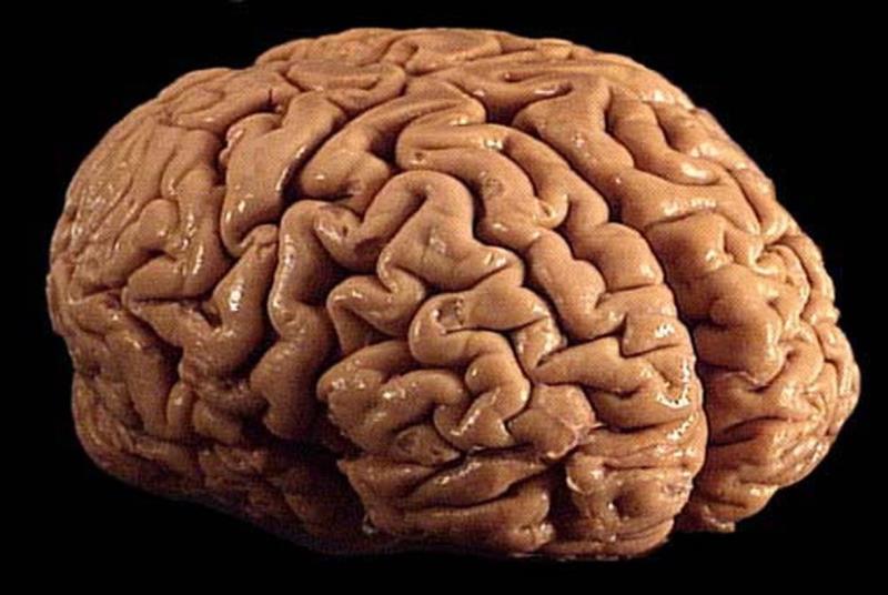 How heavy is the human brain?