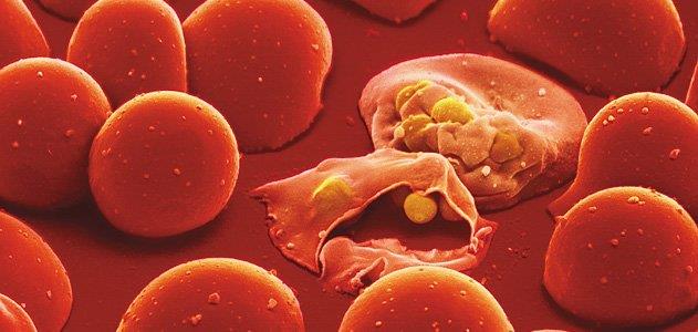 Which type of Malaria is the most dangerous?