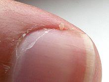 What substance are human nails made of?