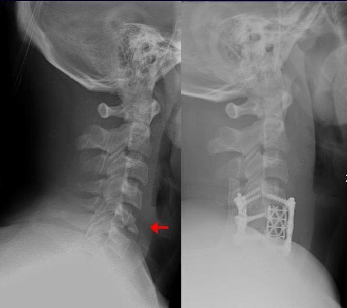 What is the meaning of the word orthopaedics in latin?
