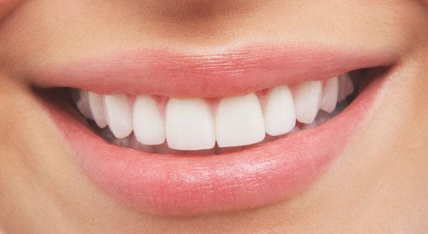 What is hypodontia?