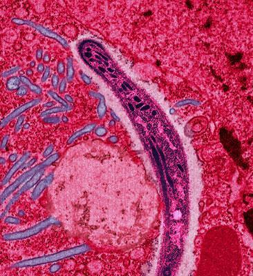 Which infectious disease is considered the deadliest on the planet?