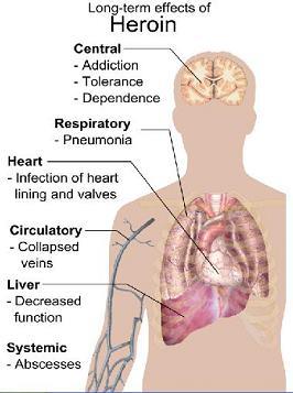What is heroin obtained from?
