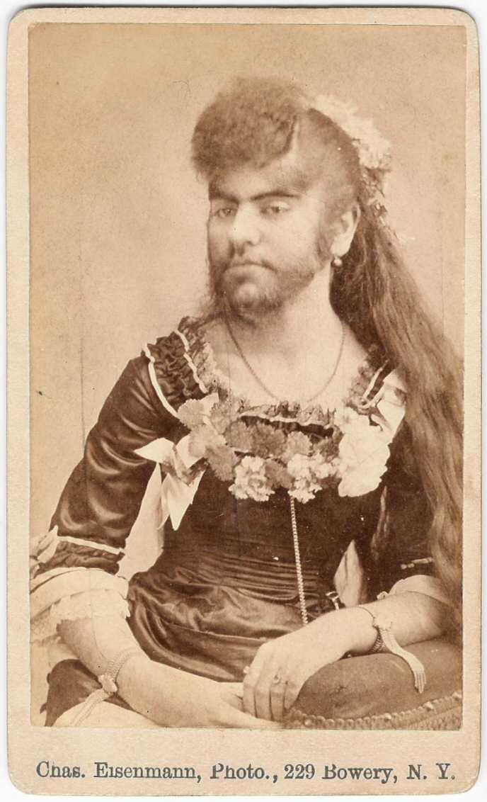 Science Trivia Question: What’s the name for excessive body hair growth in women? Science Trivia Question: What’s the name for excessive body hair growth in women?