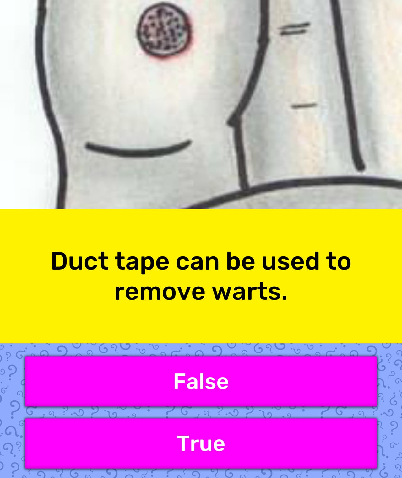 Duct tape can be used to remove warts. | Trivia Answers ...