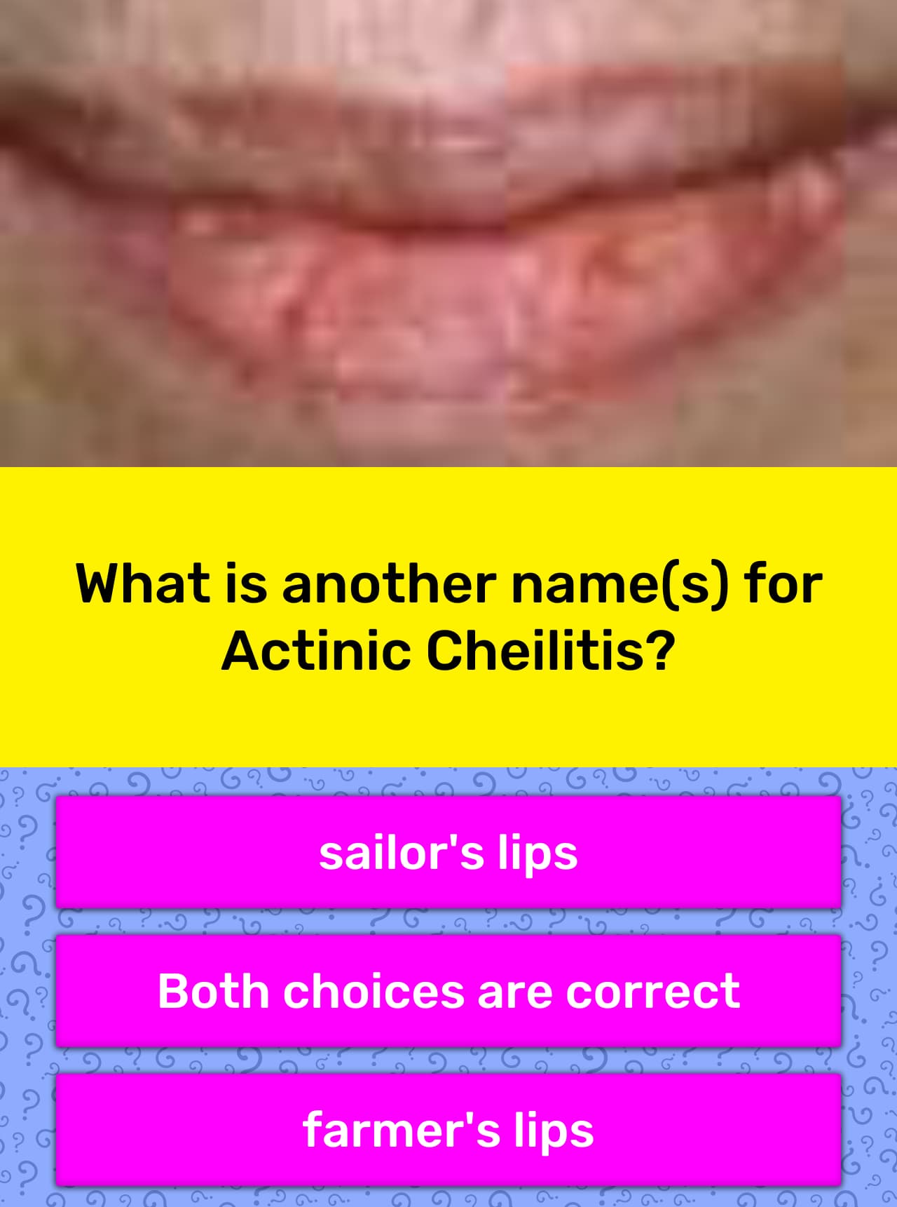 what-is-another-name-s-for-actinic-trivia-questions-quizzclub