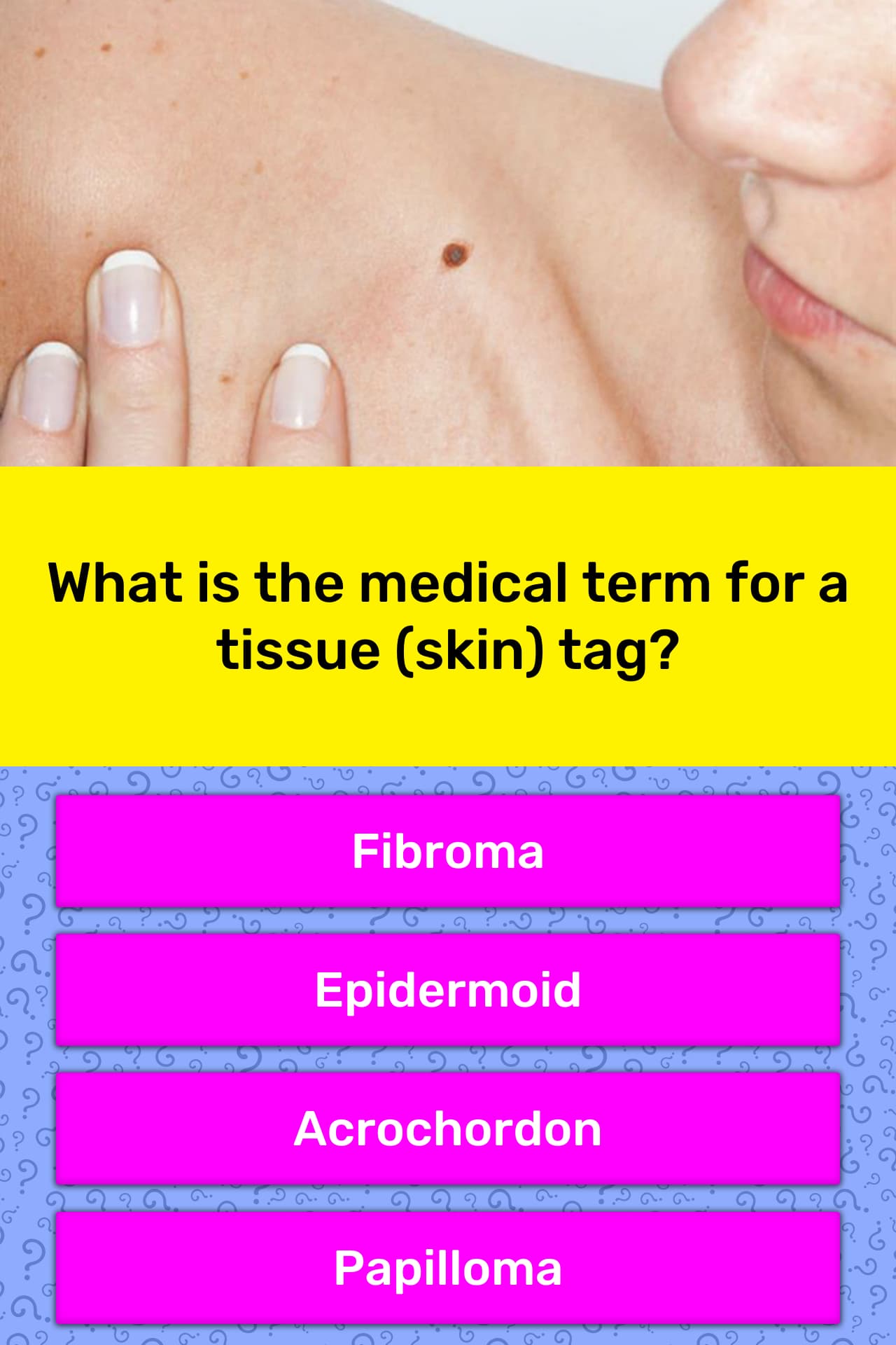 what-is-the-medical-term-for-a-trivia-answers-quizzclub