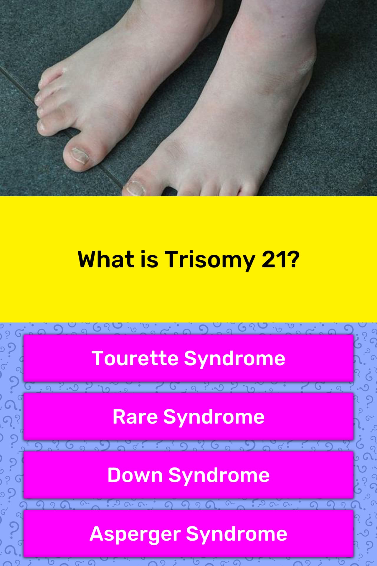 what-is-trisomy-21-trivia-answers-quizzclub