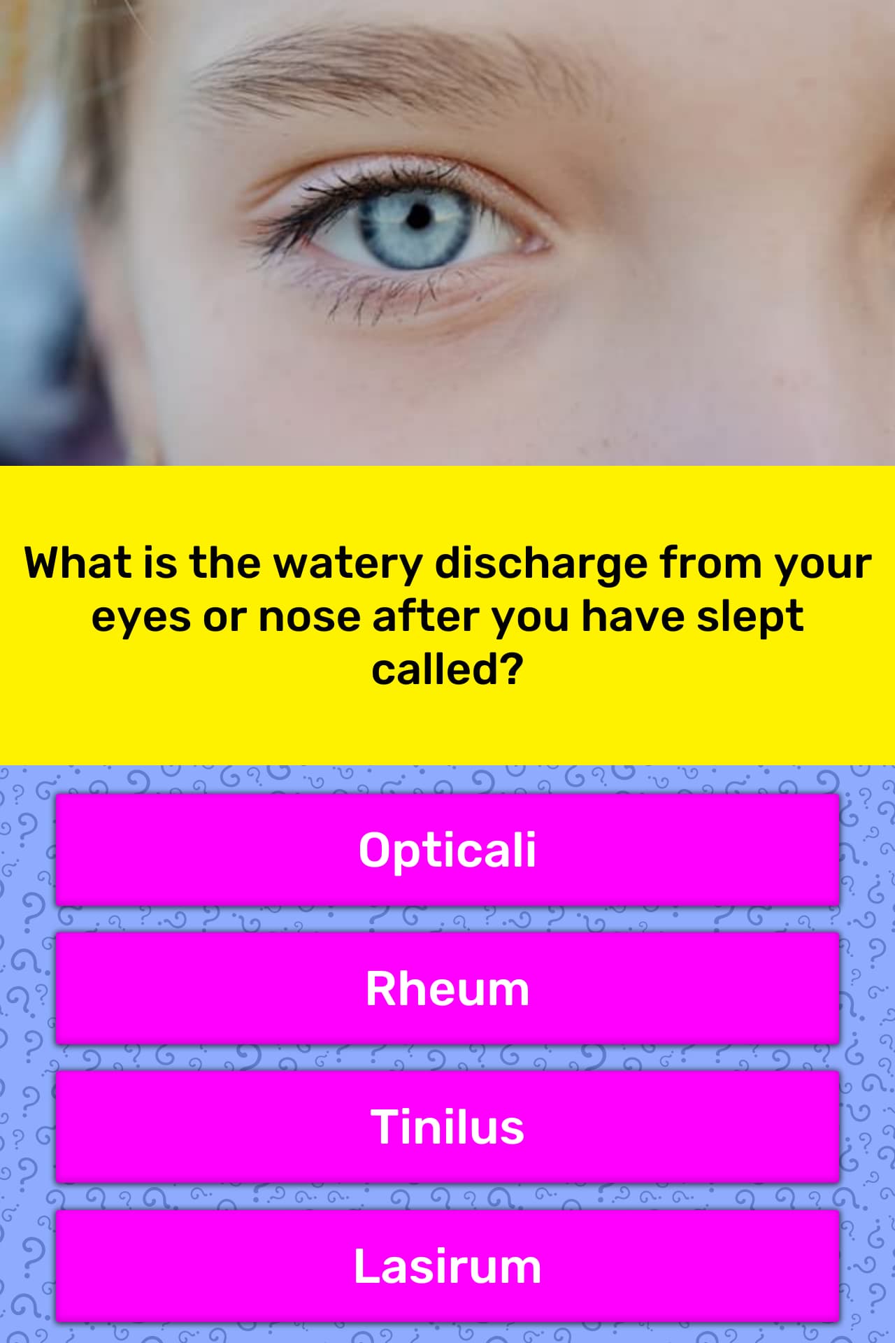 what-is-the-watery-discharge-from-trivia-answers-quizzclub