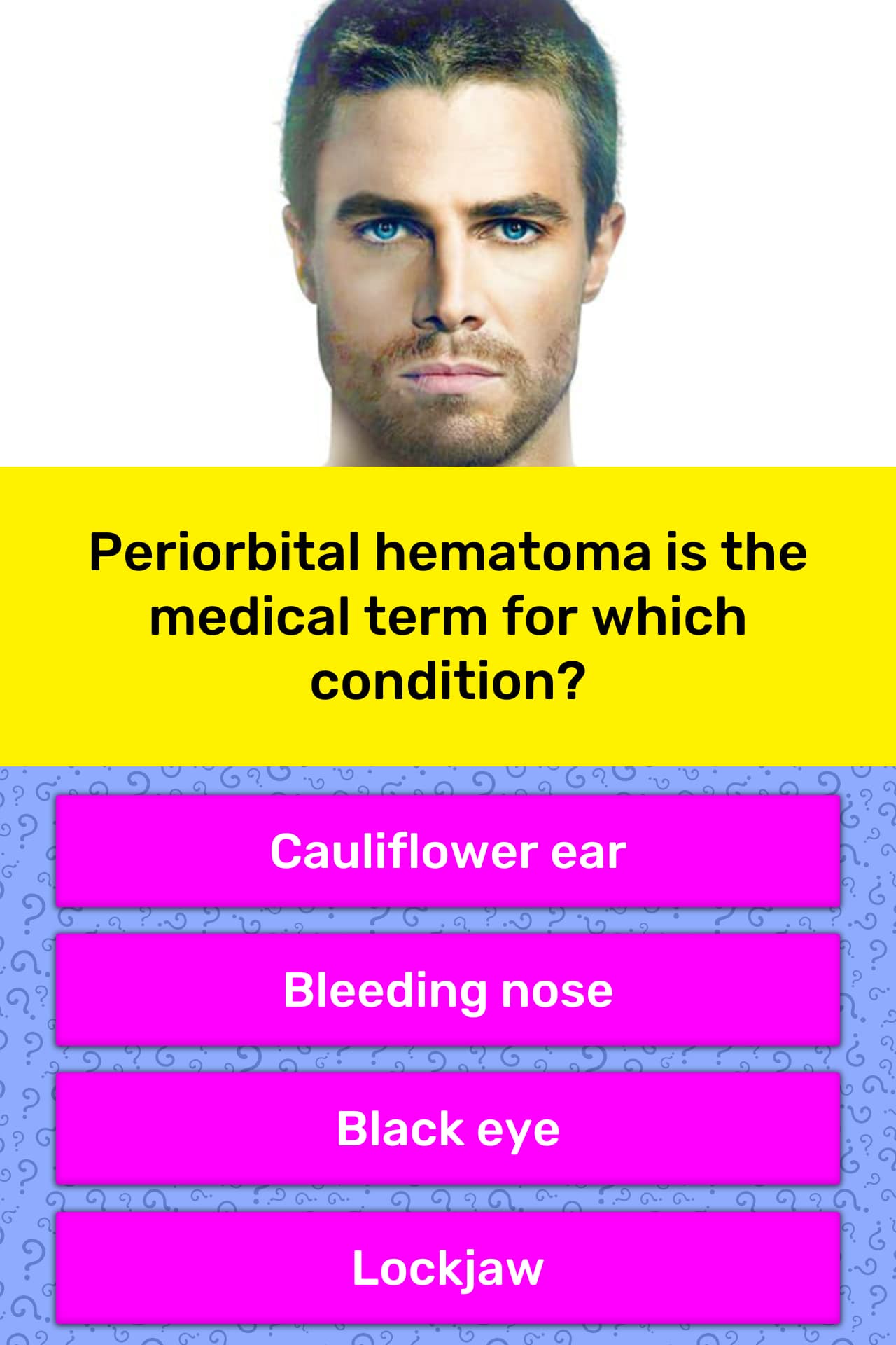 Periorbital Hematoma Is The Medical Trivia Answers QuizzClub