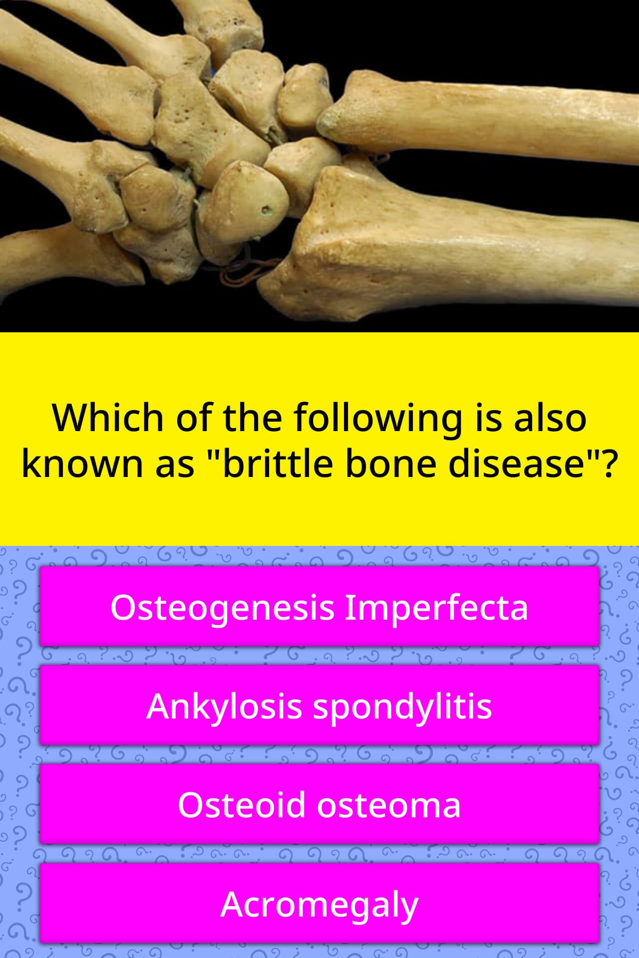 Which of the following is also known... Trivia Questions