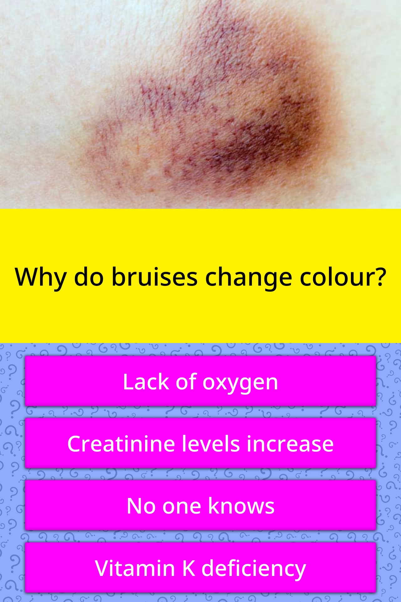 Colour Of Bruises Chart