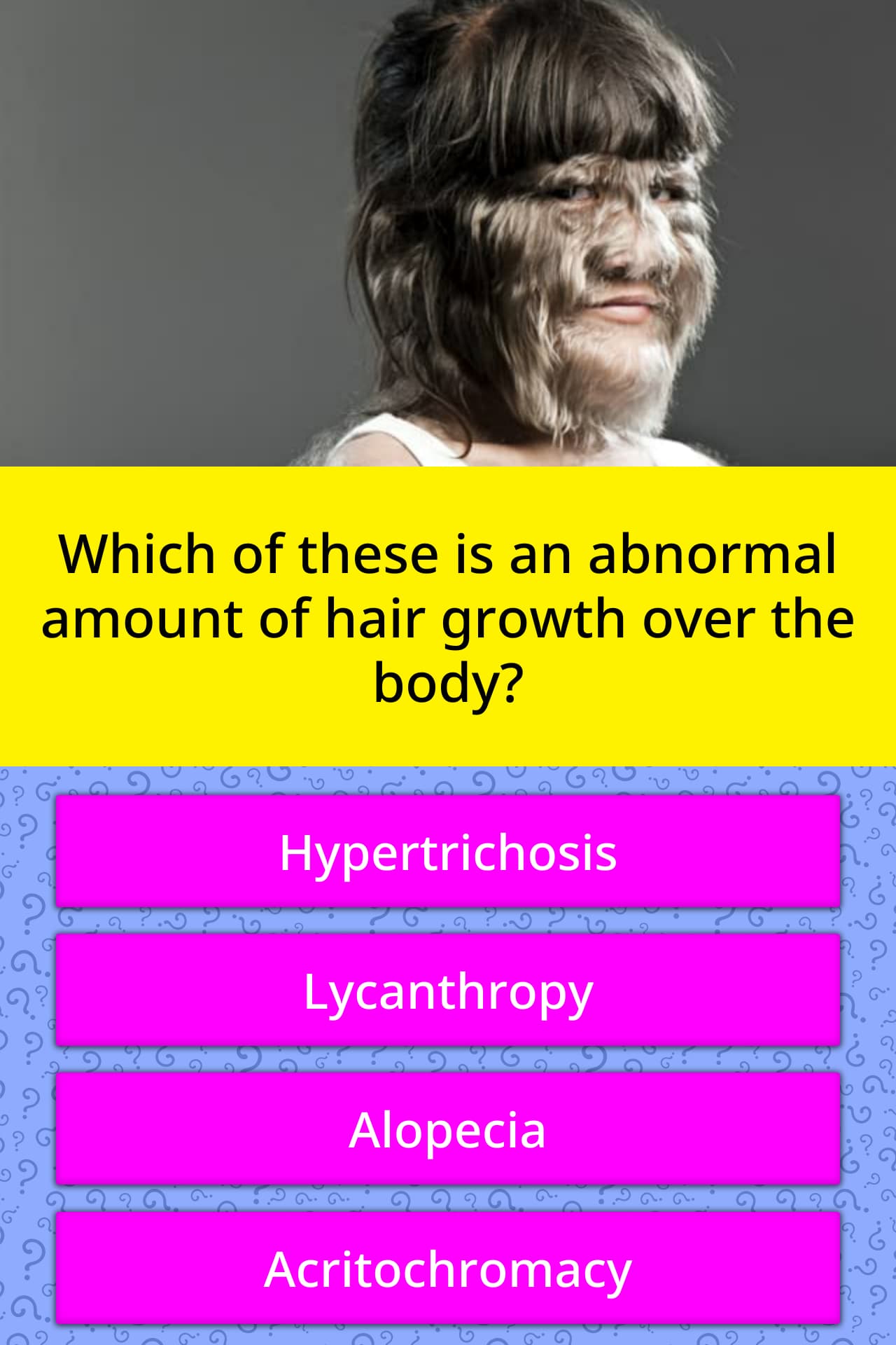 Which Of These Is An Abnormal Amount Trivia Questions QuizzClub