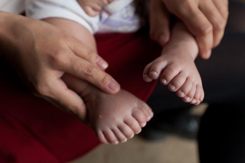 What is the anatomical anomaly where humans have more than 5 fingers on a hand or 5 toes on a foot? What is the anatomical anomaly where humans have more than 5 fingers on a hand or 5 toes on a foot?