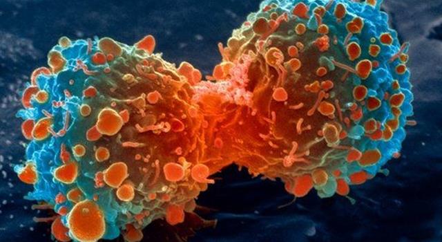 Science Trivia Question: Which of these cancers has the highest mortality rate in the US? Science Trivia Question: Which of these cancers has the highest mortality rate in the US?