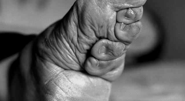 What major culture used the binding of women's feet as a symbol of beauty?