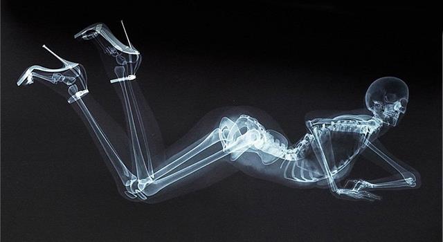 Science Trivia Question: The first X-ray picture taken was of which part of the human body? Science Trivia Question: The first X-ray picture taken was of which part of the human body?