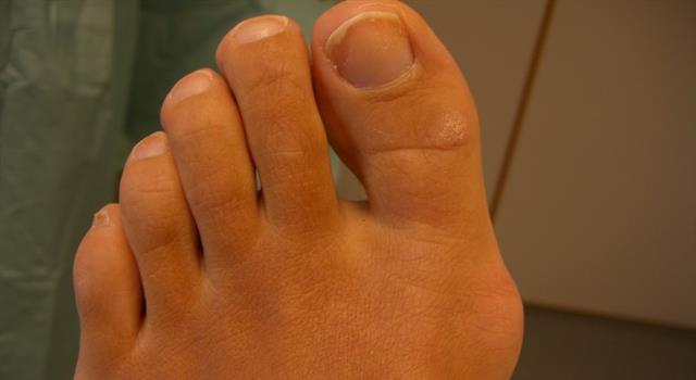 Science Trivia Question: Which one of your toes is also known as your "hallux"? Science Trivia Question: Which one of your toes is also known as your "hallux"?
