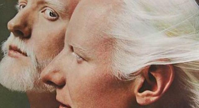 With what congenital disorder were recording artist brothers Johnny and Edgar Winters born? With what congenital disorder were recording artist brothers Johnny and Edgar Winters born?