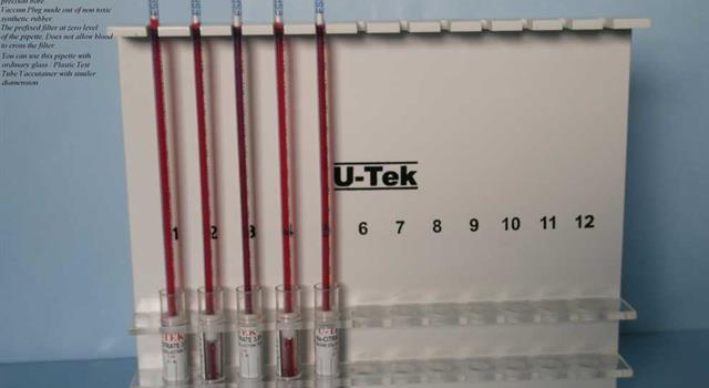 Science Trivia Question: One of the common blood tests is ESR, what does it stand for? Science Trivia Question: One of the common blood tests is ESR, what does it stand for?