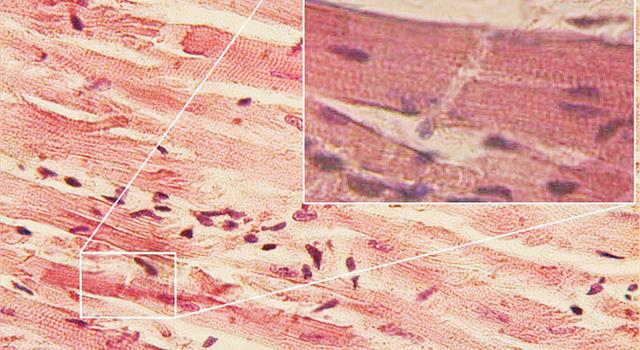 Science Trivia Question: What is the name of the muscle (middle layer) of the heart? Science Trivia Question: What is the name of the muscle (middle layer) of the heart?
