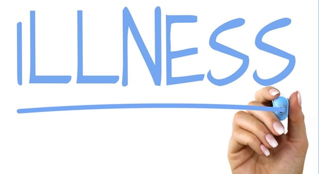 Science Trivia Question: What do you lose when suffering from phalacrosis? Science Trivia Question: What do you lose when suffering from phalacrosis?